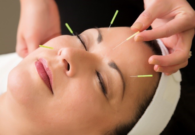 Balancing Your Inner Energy with Acupuncture